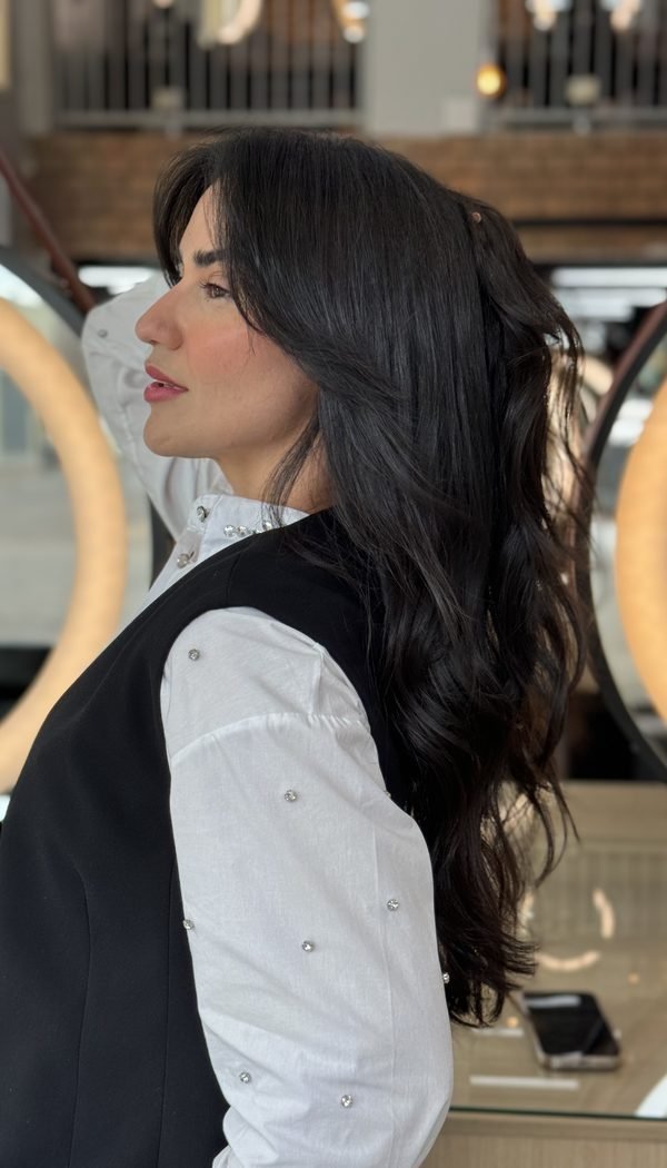 Harmonização facial — resultado em perfil