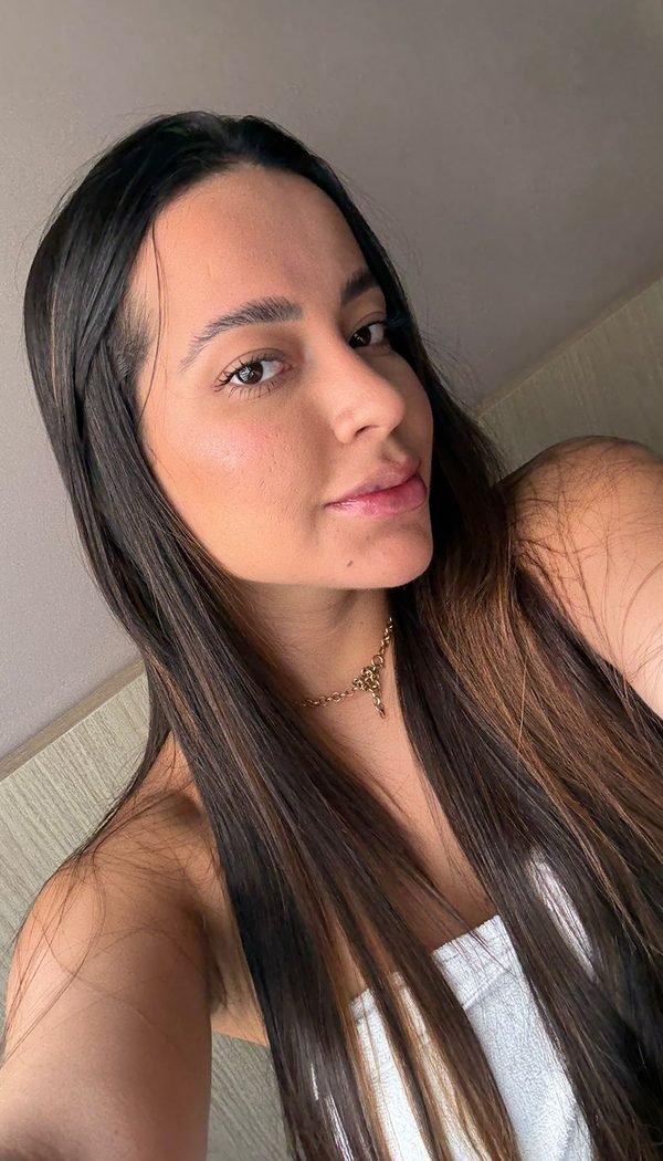 Paciente após harmonização facial